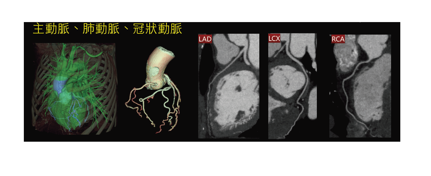 掃一顆心臟只要0 275秒 三總 640列電腦斷層 減半輻射量 Ettoday健康雲 Ettoday新聞雲